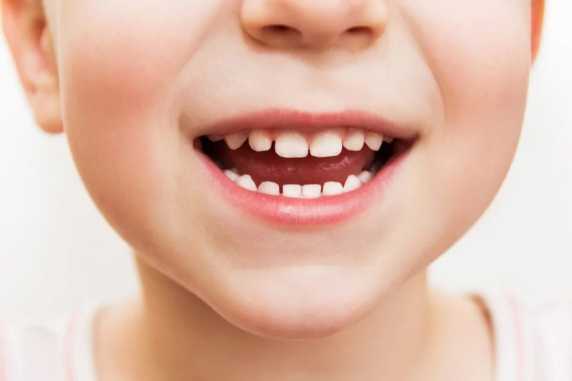 Детские зубы 1.jpg